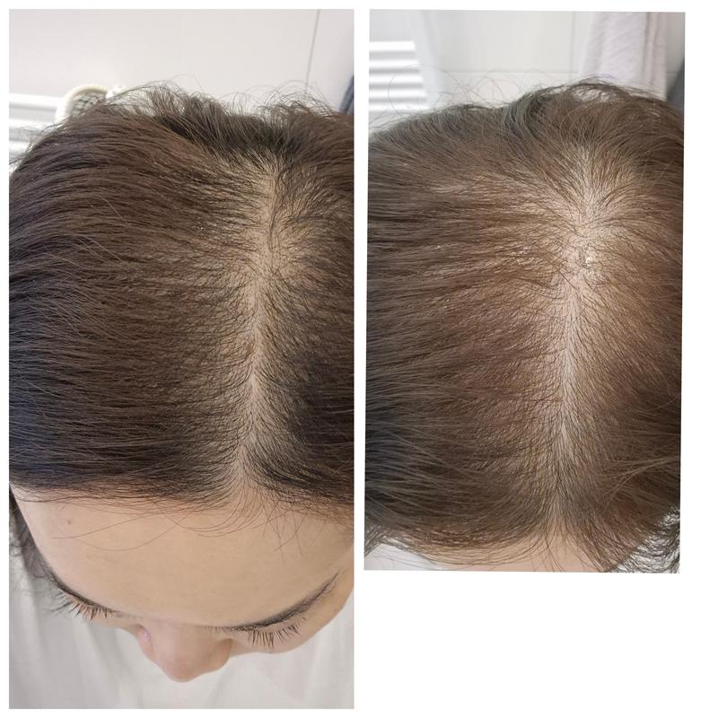 ghk cu copper peptide benefits The Ordinary Multi Peptide Serum for Hair Density Review: In‑Depth Analysis  and Results | the ordinary multi peptide serum for hair density review and  more