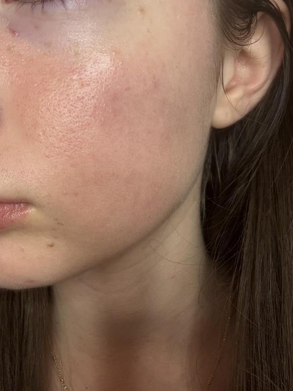 Customer photo for "Good glow and sustainable"
