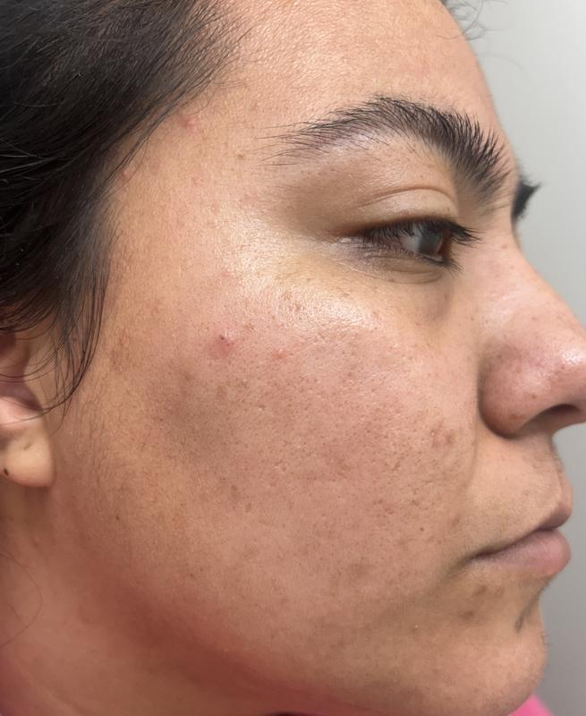 Review Thumbnail Image 1 382371222