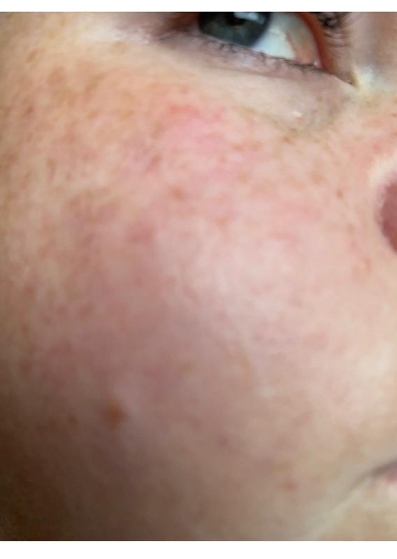 Customer photo for "brighter, glower skin in 6wks (5% now please!!)"