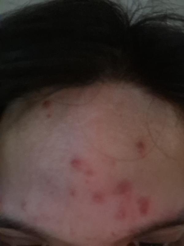 Customer photo for "Purging"