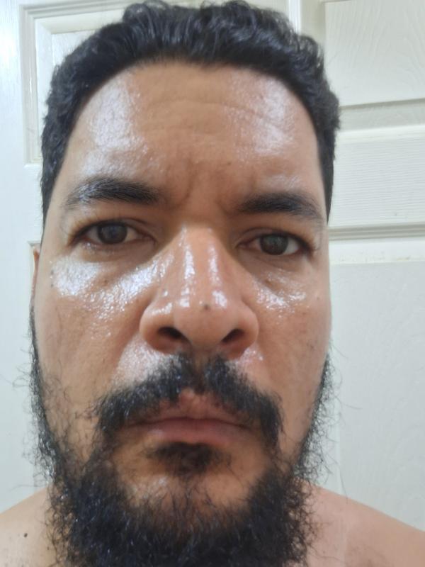 Customer photo for "Not suitable for oily skin"