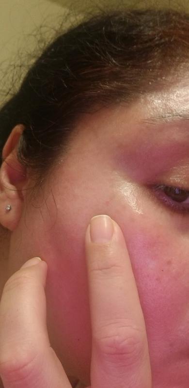 Review Thumbnail Image 0 382182485