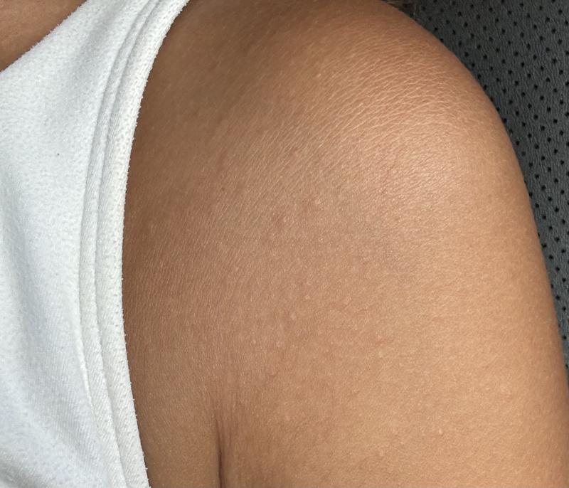 Review Thumbnail Image 1 381805098