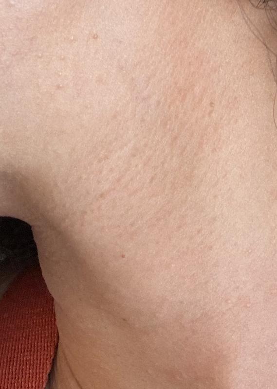 Review Thumbnail Image 0 381805098