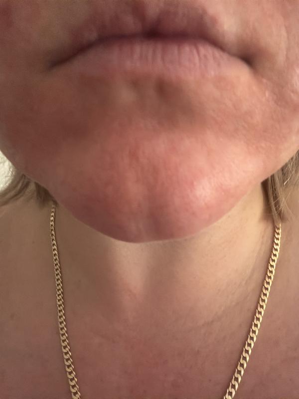 Customer photo for "Miracle serum"