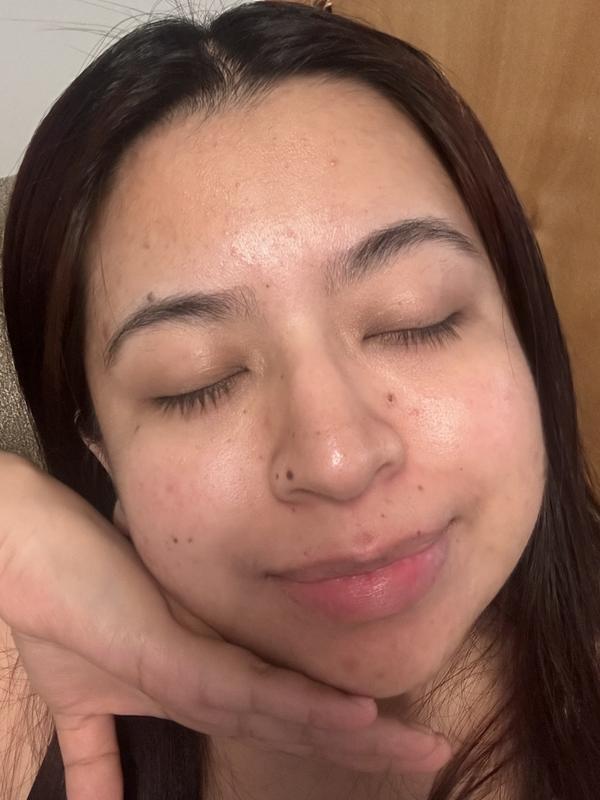 Review Thumbnail Image 0 383398085