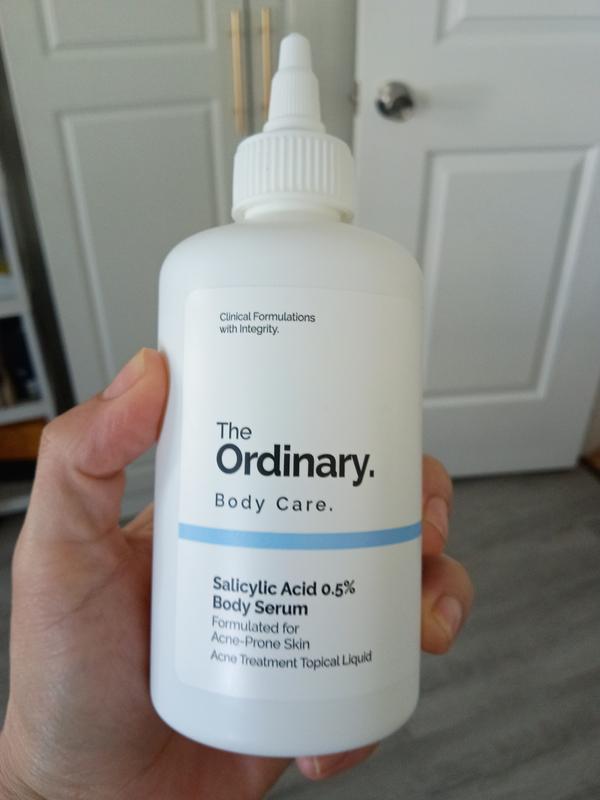 Customer photo for "Great for back acne"