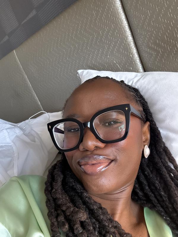 Customer photo for "For Acne"