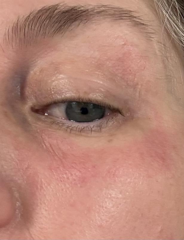 Review Thumbnail Image 0 383484640