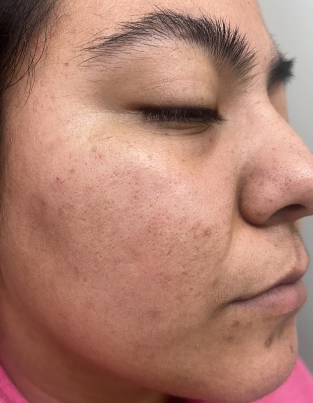 Review Thumbnail Image 0 382371222