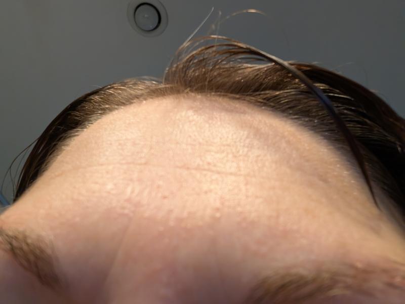 Customer photo for "Bumpy skin after using twice"