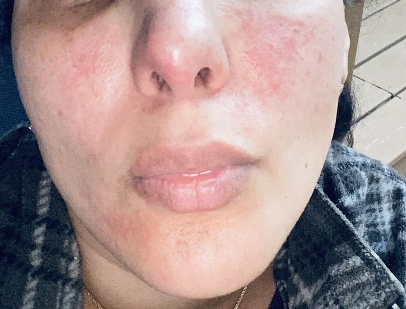 Customer photo for "Horrible!"