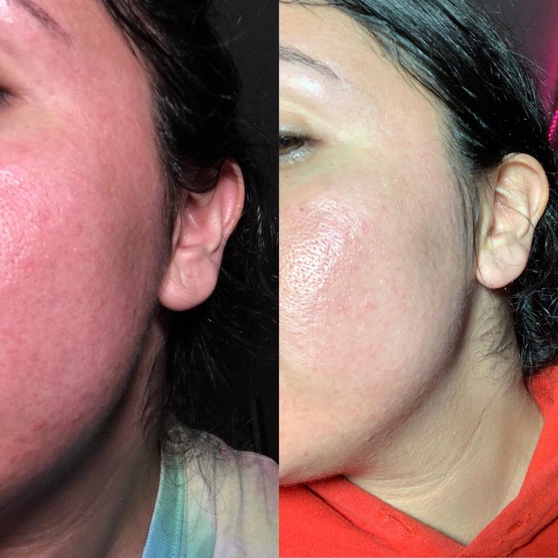 3 week progress. Every. Single. Night!