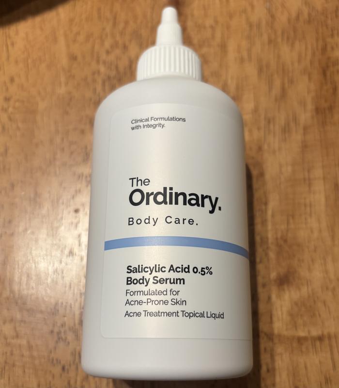 Customer photo for "Great for acne!"