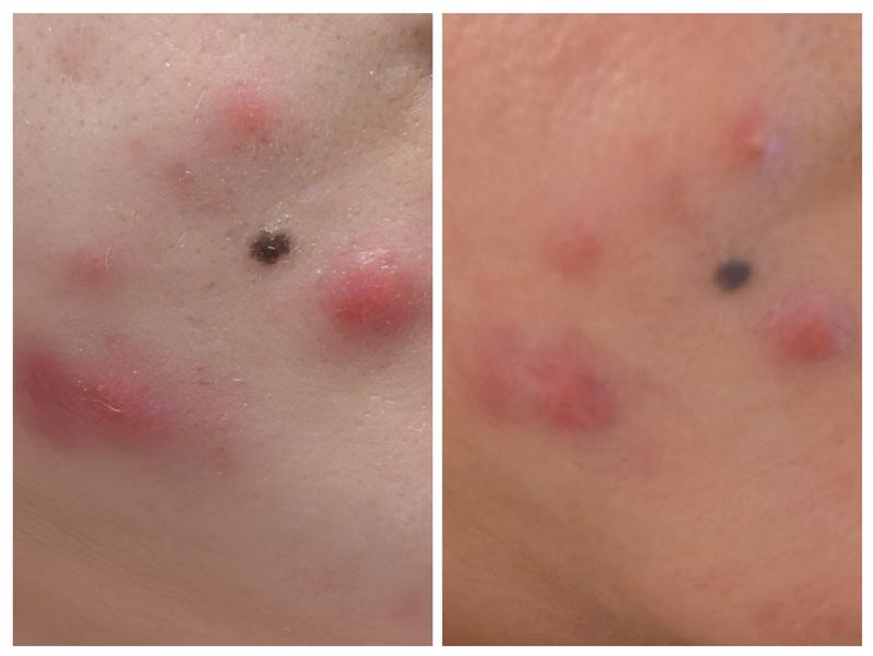 Review Thumbnail Image 0 382380216