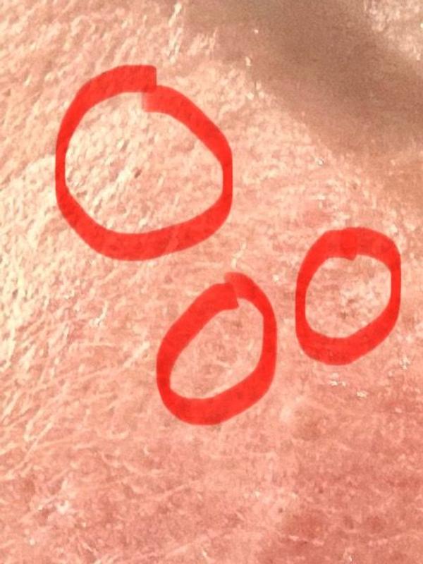 Customer photo for "Didn’t remove any blackheads :-("