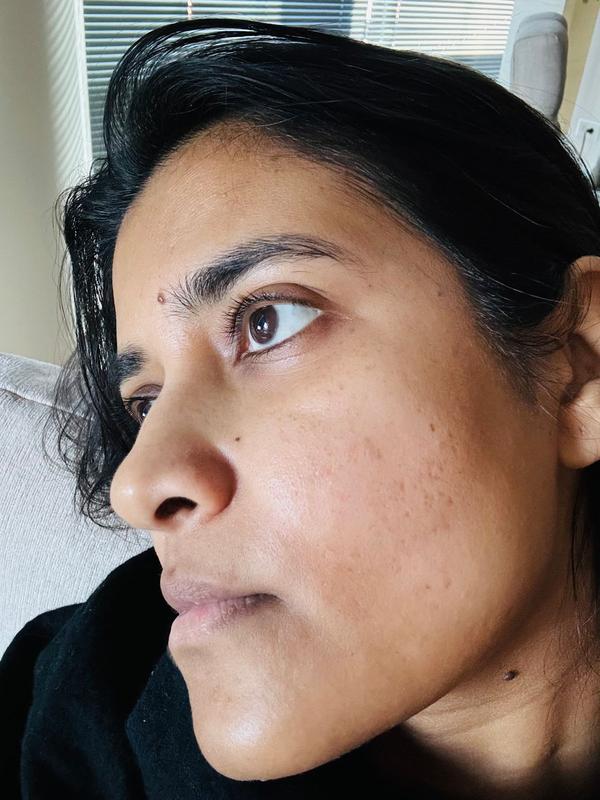 Customer photo for "Best facial ever"