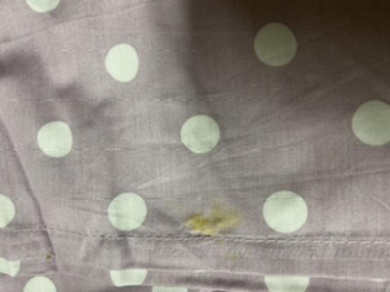 Yellow stain on fitted and flat sheet