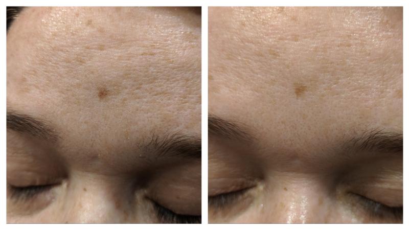 Dark Spot Correcting Serum Differin