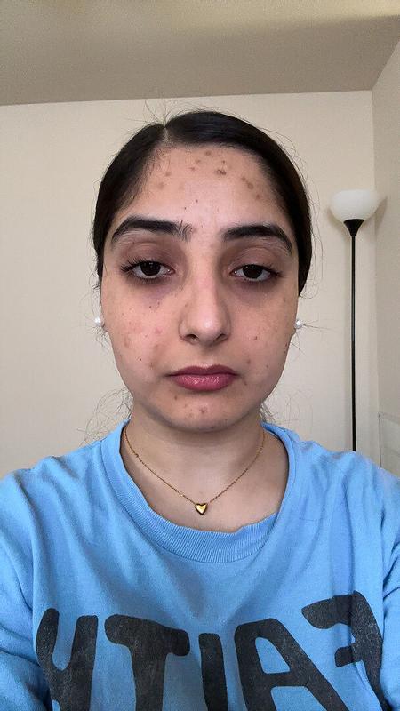 Review Thumbnail Image 0 378895618