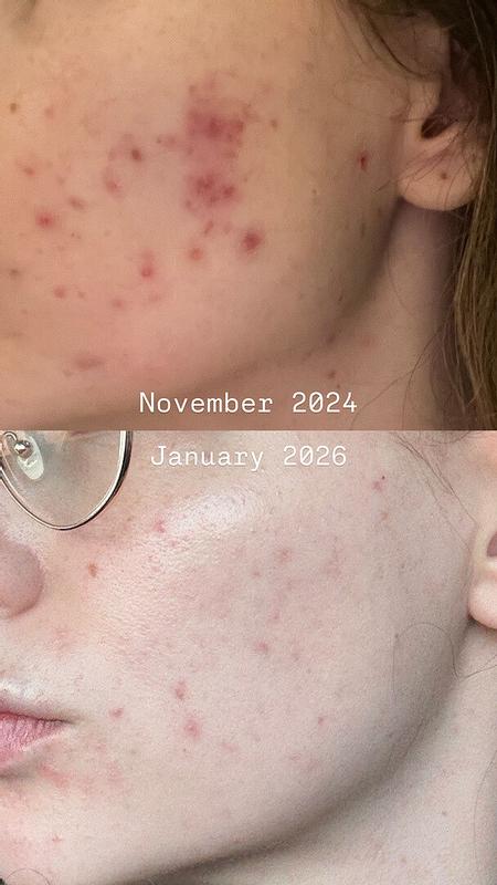 Review Thumbnail Image 0 380179710