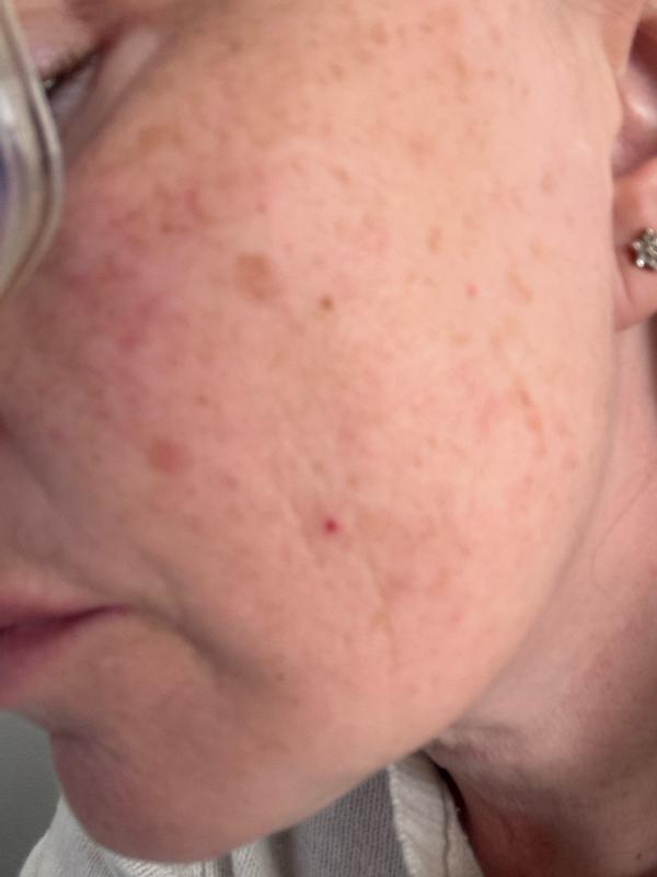 Review Thumbnail Image 0 1218129443