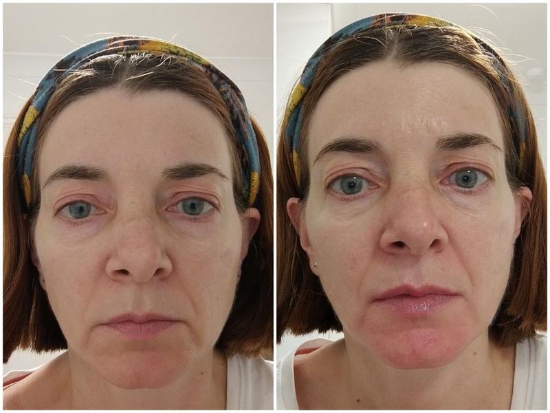 Customer photo for "Fragrance free and light texture"