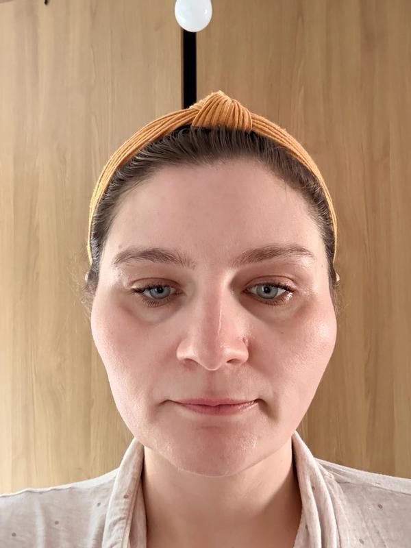Customer photo for "Patience releases hydration results"