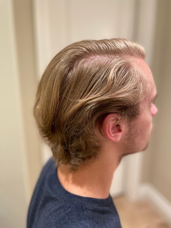 Before