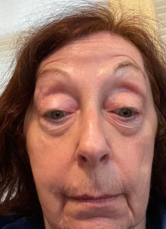 No remarkable results yet