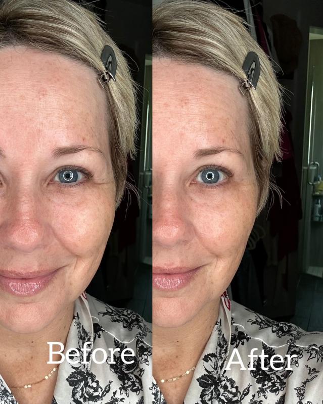 Perfect for larger pores