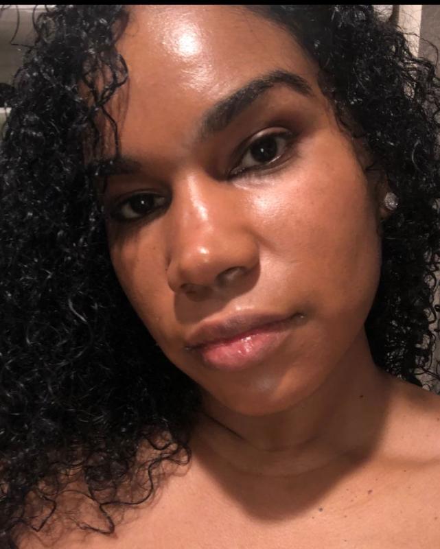 Best Acne treatment in the market