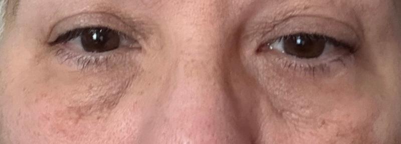 Disappointed with the Results