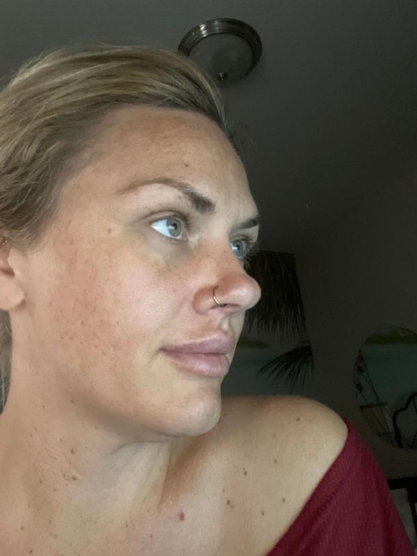 Excited to see fine lines filing in!