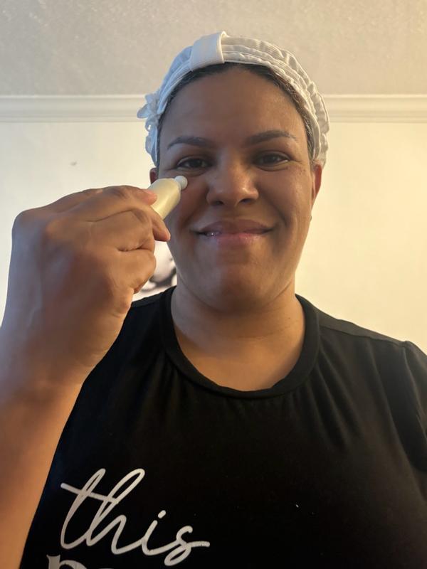 Customer photo for "Eyes rejuvenated in weeks"
