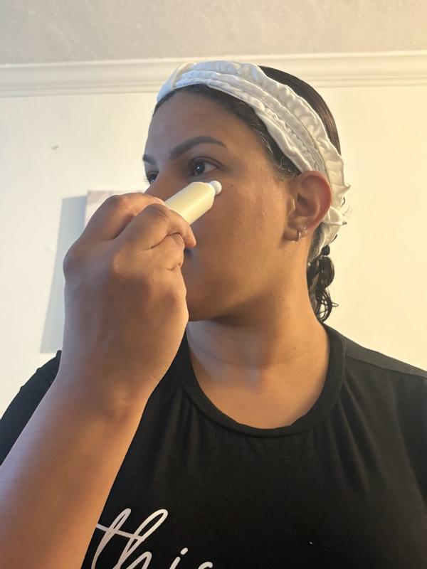 Customer photo for "Eyes rejuvenated in weeks"