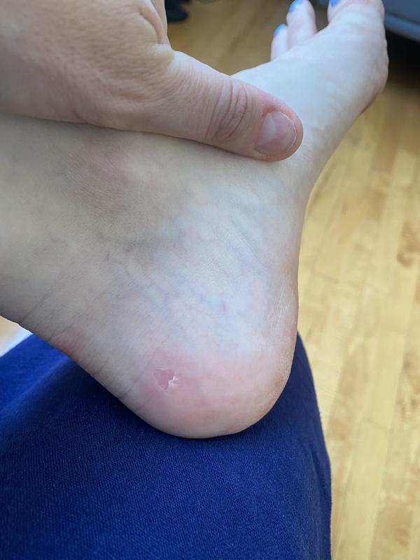 Blisters on both heels after 1 wear.