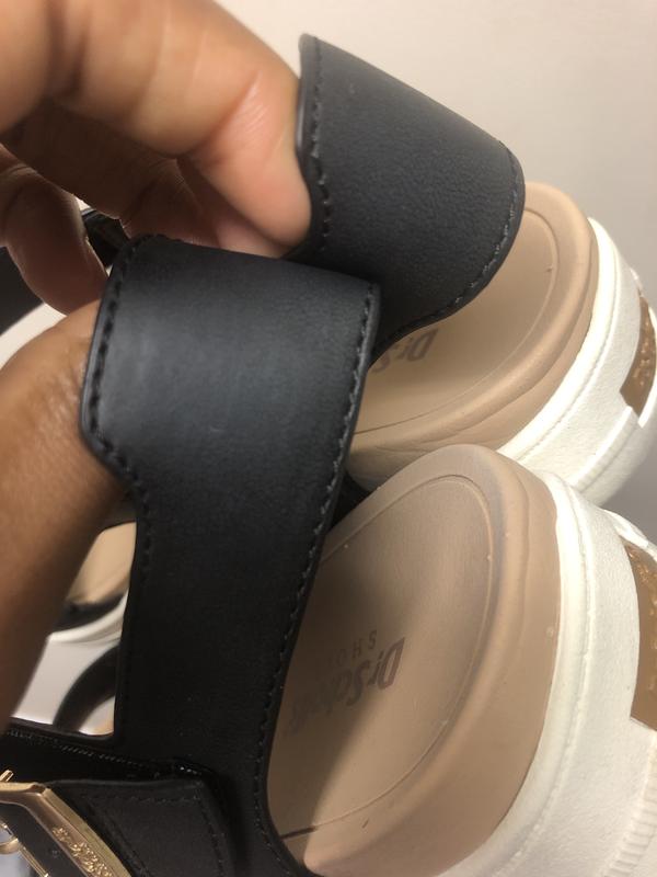 Nodules on heel