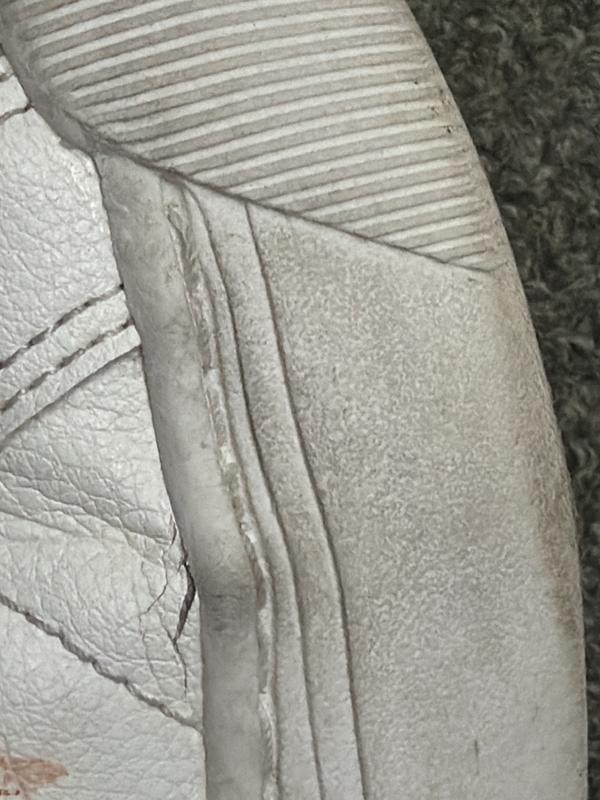 The material is falling apart on both left and right shoes