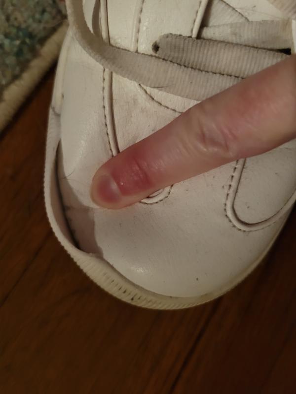 Sole coming apart