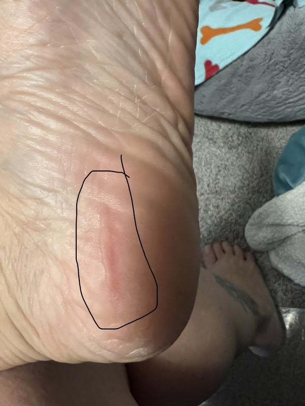 Photo submitted with review of product