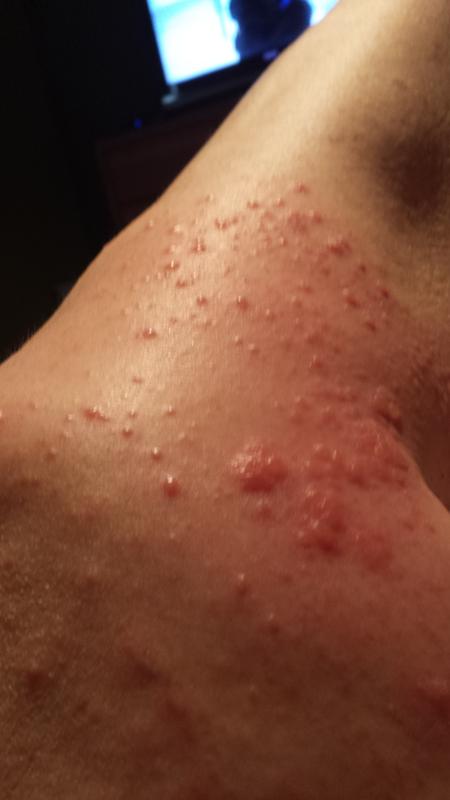 Photo submitted with review of product