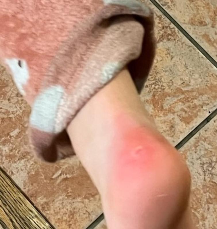 Photo submitted with review of product