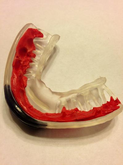Photo submitted with review of product