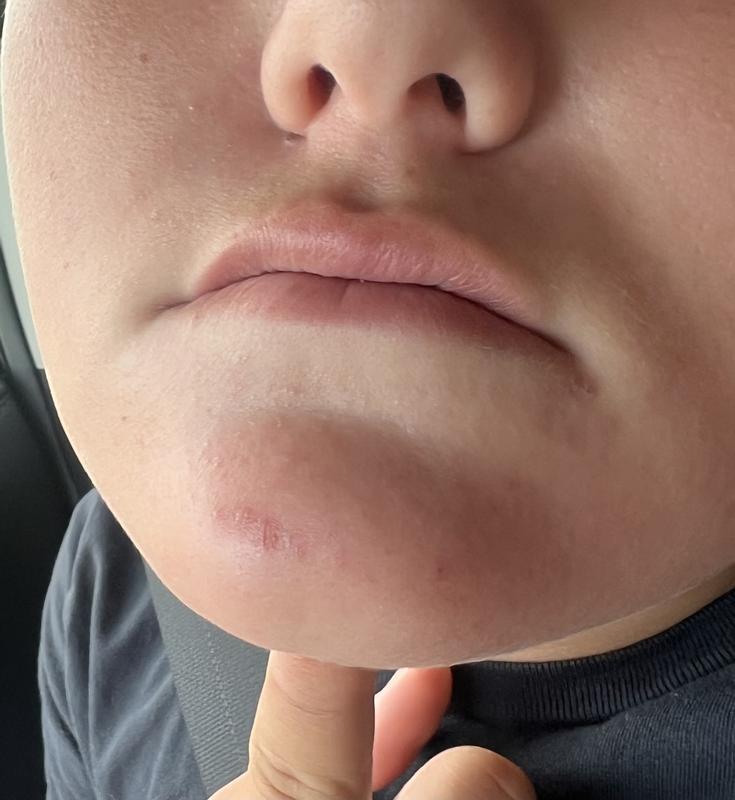 Photo submitted with review of product