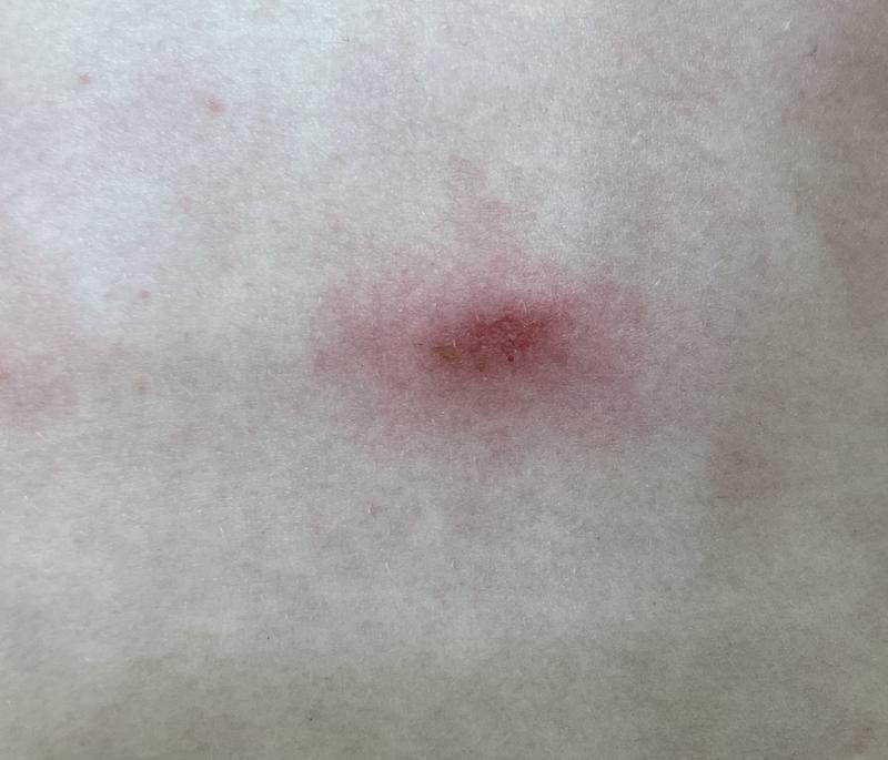 Photo submitted with review of product