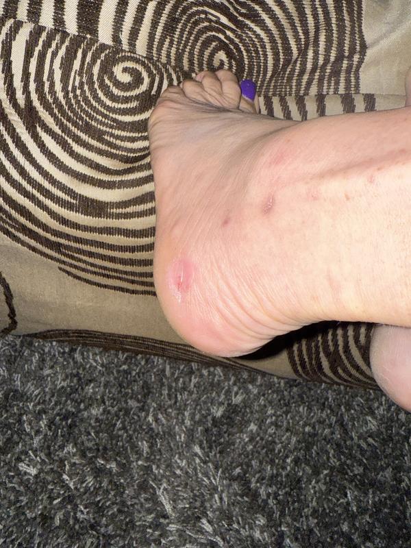 Photo submitted with review of product
