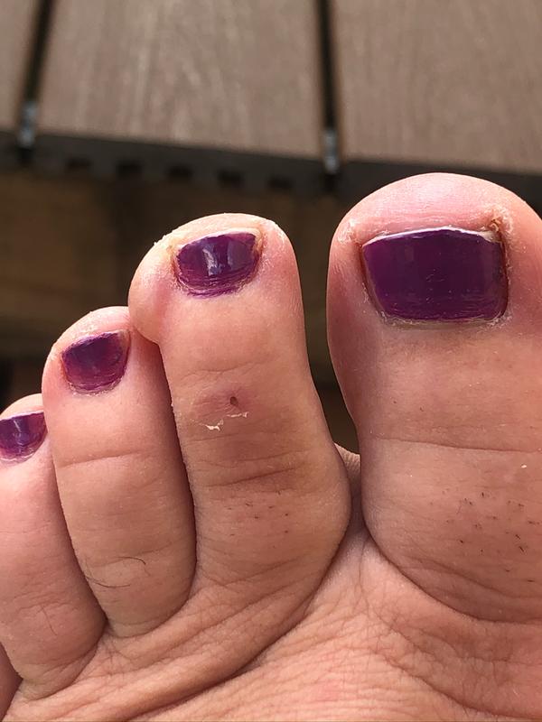 Photo submitted with review of product