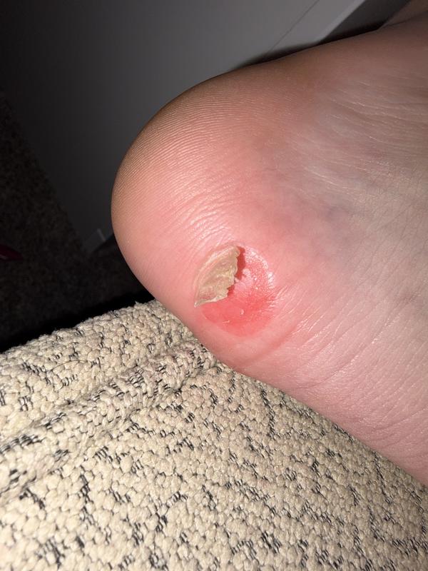 Photo submitted with review of product